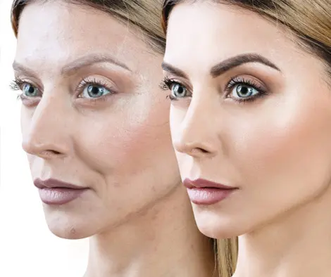 Anti-Aging