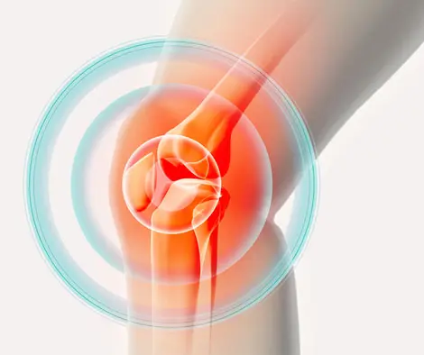 Bone Health