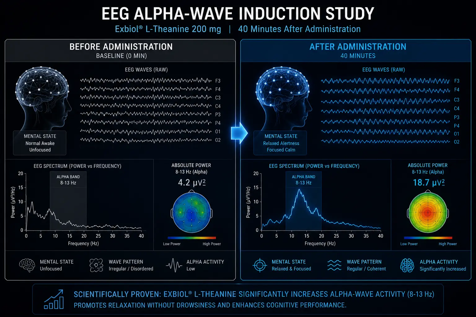 L-Theanine EEG Study